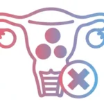 Fibroid Treatment