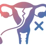 Recurrent Miscarriage