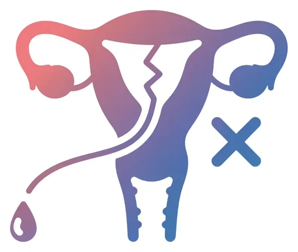Recurrent Miscarriage